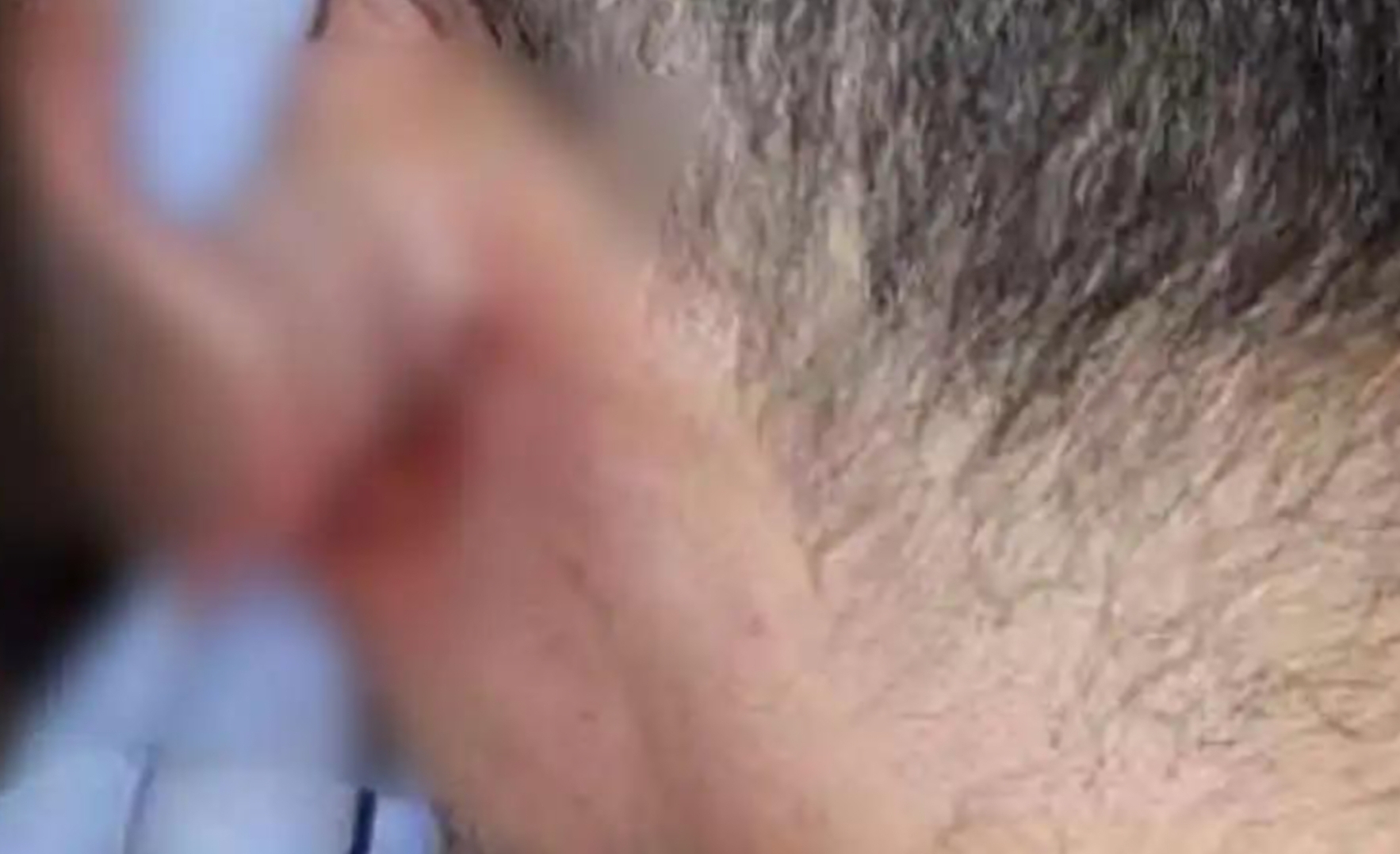 Barcellona, staccò un pezzo di orecchio a morsi dopo lite in un bar: indagato il titolare